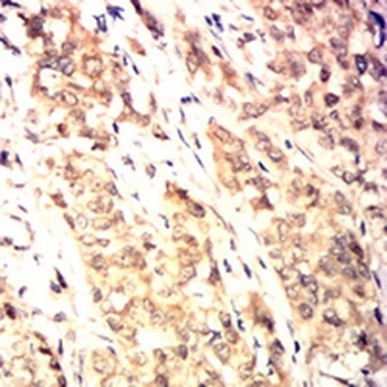 HSPA4 Mouse Monoclonal Antibody