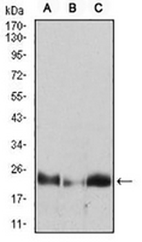 HPRT Mouse Monoclonal Antibody