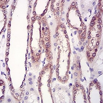 HPRT Mouse Monoclonal Antibody