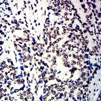 hnRNP M Mouse Monoclonal Antibody