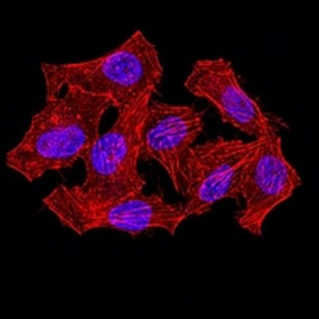 hnRNP M Mouse Monoclonal Antibody