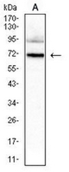 HNF1 beta Mouse Monoclonal Antibody