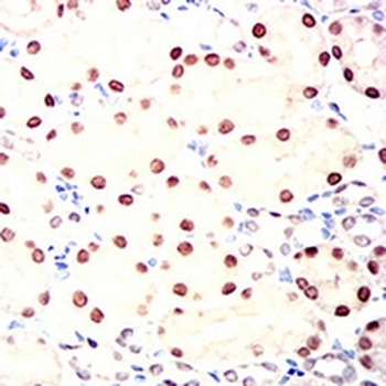HNF1 beta Mouse Monoclonal Antibody