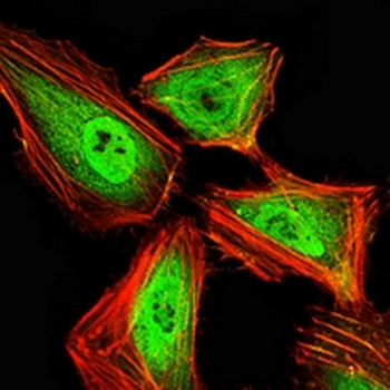 HNF1 beta Mouse Monoclonal Antibody