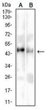 HLA-F Mouse Monoclonal Antibody