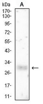 HLA-DRB1 Mouse Monoclonal Antibody