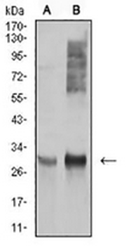 HLA-DRA Mouse Monoclonal Antibody
