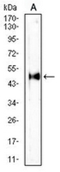 HLA-C Mouse Monoclonal Antibody
