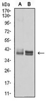 HLA-B Mouse Monoclonal Antibody