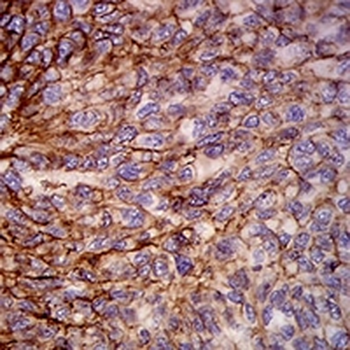 HLA-B Mouse Monoclonal Antibody