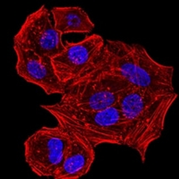 HLA-B Mouse Monoclonal Antibody