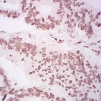 Histone H4 (MonoMethyl-K20) Mouse Monoclonal Antibody