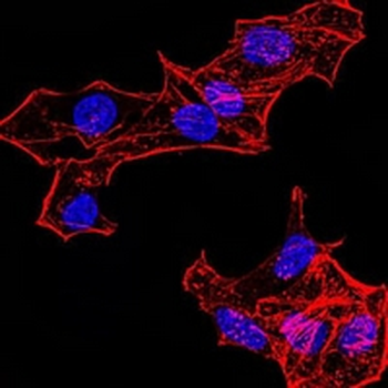 Histone H4 (MonoMethyl-K20) Mouse Monoclonal Antibody