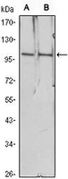 Histone Deacetylase 4 Mouse Monoclonal Antibody