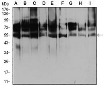 Histone Deacetylase 2 Mouse Monoclonal Antibody