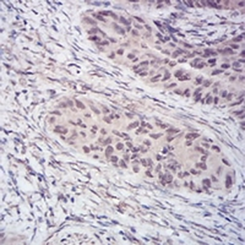 Histone Deacetylase 2 Mouse Monoclonal Antibody