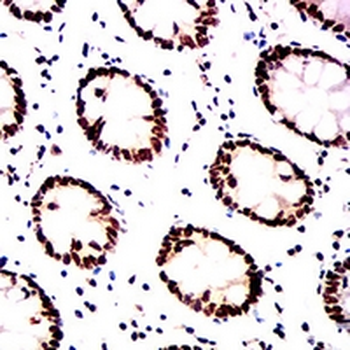Histone Deacetylase 1 Mouse Monoclonal Antibody