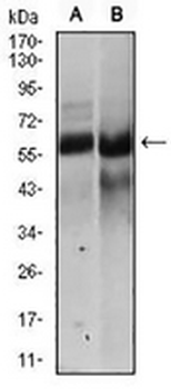 HAS2 Mouse Monoclonal Antibody