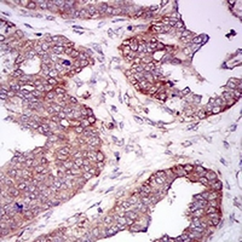 HAS2 Mouse Monoclonal Antibody