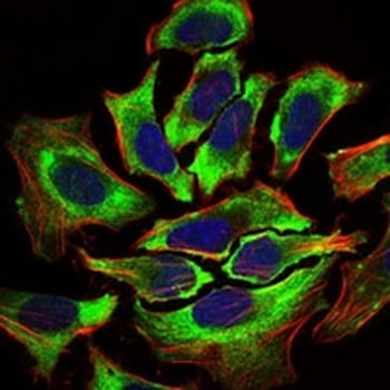 HAS2 Mouse Monoclonal Antibody