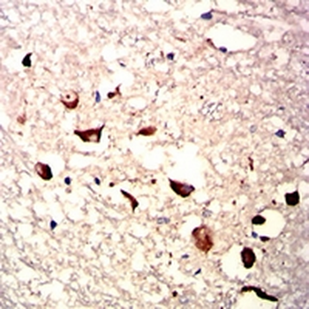 HAS1 Mouse Monoclonal Antibody