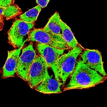 HAS1 Mouse Monoclonal Antibody