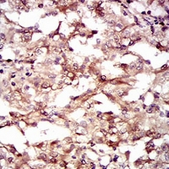 GUCY1A3 Mouse Monoclonal Antibody