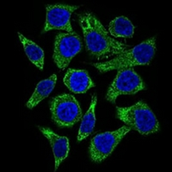 GUCY1A3 Mouse Monoclonal Antibody