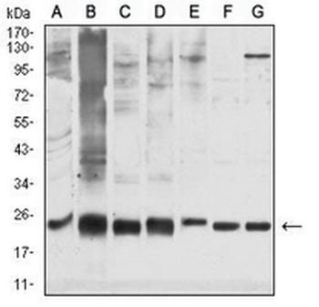 GSTP1 Mouse Monoclonal Antibody