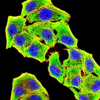 GSTP1 Mouse Monoclonal Antibody
