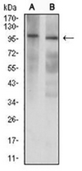 GRIK3 Mouse Monoclonal Antibody