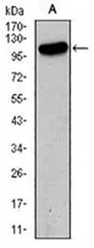 GLUR2 Mouse Monoclonal Antibody