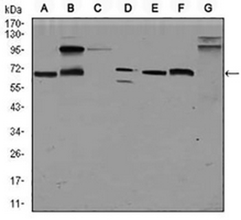 Glypican 3 Mouse Monoclonal Antibody