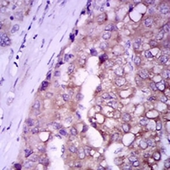 Glypican 3 Mouse Monoclonal Antibody