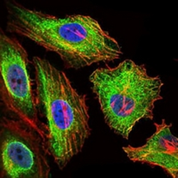 Glypican 3 Mouse Monoclonal Antibody