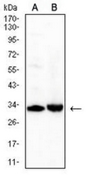 CD42a Mouse Monoclonal Antibody