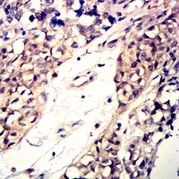 CD42a Mouse Monoclonal Antibody