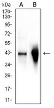 Glutamine Synthetase Mouse Monoclonal Antibody