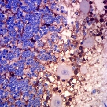 Glutamine Synthetase Mouse Monoclonal Antibody