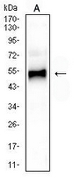 GATA3 Mouse Monoclonal Antibody