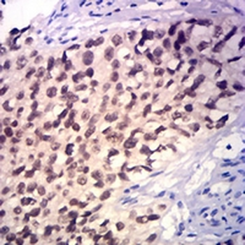 GATA3 Mouse Monoclonal Antibody