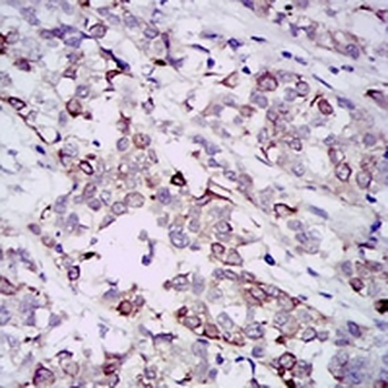 GAB1 Mouse Monoclonal Antibody