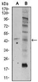 Frizzled 5 Mouse Monoclonal Antibody