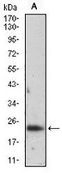 Ferritin L Mouse Monoclonal Antibody