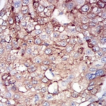 Ferritin L Mouse Monoclonal Antibody