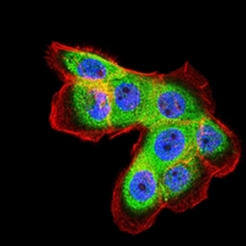 Ferritin L Mouse Monoclonal Antibody