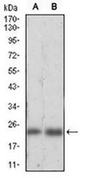 Ferritin L Mouse Monoclonal Antibody