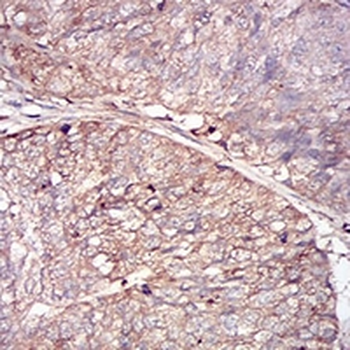 Ferritin L Mouse Monoclonal Antibody