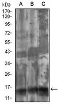 FSH beta Mouse Monoclonal Antibody