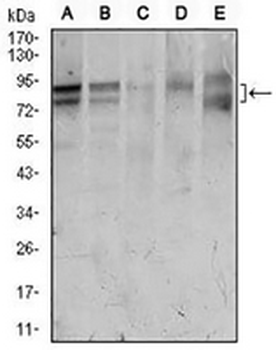 FOXP1 Mouse Monoclonal Antibody